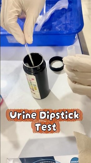 Urine Dipstick Test Explained in 30 Seconds!