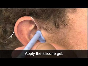 Taking Ear impressions