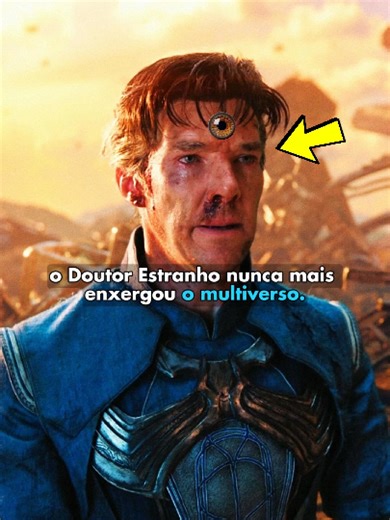 A Verdade Sobre o Terceiro Olho do Doutor Estranho