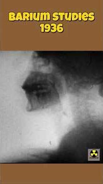 Barium Studies | Fluoroscopy - 1936 #radiology #x-ray