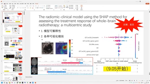 基于SHAP的脑转移瘤影像组学特征可解释性研究