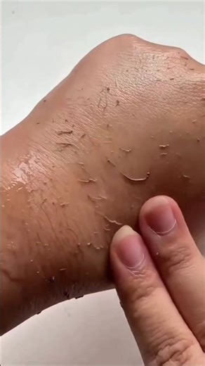 Remove Hand Dead Skin & Tanning | Dark Hand Cleaning Tips #ytshorts #hand #tanning #deadskin