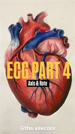 Vee | Starting the discussion on what to see on that ecg paper. ( ofc even I am just a student so this is a discussion and I may be wrong and if... | Instagram