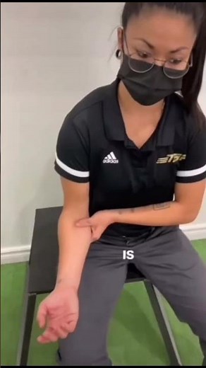 Pronator Teres Syndrome | Hand pain | Median Nerve