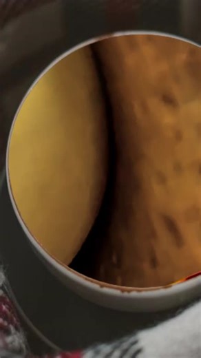 Effective Blackhead Removal Tips for Clear Skin