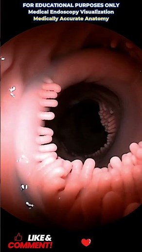 #MedicalEducation #HumanAnatomy #Endoscopy