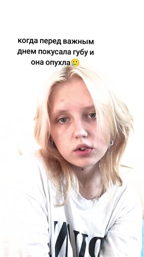 How to Treat a Swollen Lip from a Bite