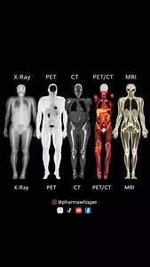 Medical Imaging Modalities: See the Body Like Never Before Explore how different medical imaging techniques visualize the human body—from basic structure to advanced metabolic activity. This clean, high-impact visual comparison helps medical, pharmacy, and radiology students quickly understand what each modality shows and when it’s used. ✨ Why this infographic is valuable: ✔️ Side-by-side comparison of X-Ray, PET, CT, PET/CT & MRI ✔️ Shows structural vs functional imaging clearly ✔️ Perfect for 