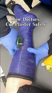 How Doctors Cut Plaster Safely 🩹 #MedicalTips #FirstAidFacts
