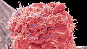 How HIV destroys the immune system