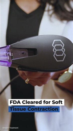 Morpheus8 Skin Tightening Treatment | RF Microneedling for Smoother, Firmer Skin 😉