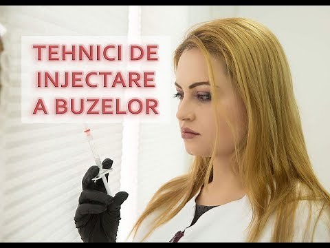 Tehnici de injectare a buzelor cu acid hialuronic