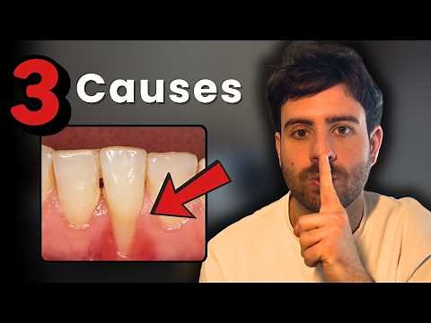 Your Gums Recede for One of These 3 Reasons