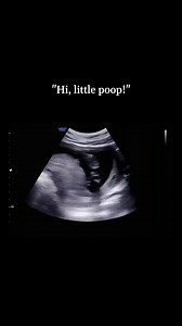 1.2K views · 20 reactions | K-parenting 101: Do unborn babies need...