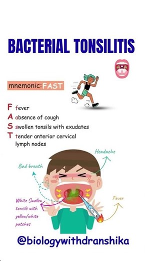 Bacterial Tonsillitis: Sore throat that needs treatment 🦠😷#bacterial #tonsillitis #sore #throatcare