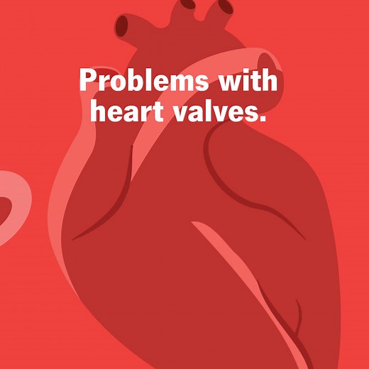 Congenital heart disease is the most common type of birth defect. It can be detected before birth, soon after birth or anytime throughout life. A person with CHD should see a cardiologist regularly throughout life. #LoveYourHeart | Cleveland Clinic Children's | Facebook