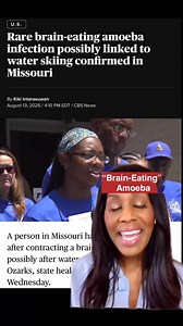 642K views · 2.1K reactions | Brain eating Amoeba #braineatingamoeba | Dr. Jen Caudle | Facebook