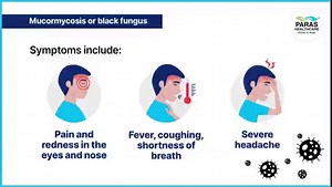 4.7M views · 6.1K reactions | #Mucormycosis, or black fungus, is a rare fungal disease that can become life-threatening if left untreated. Doctors suspect that it could affect a lot of COVID patients in recovery. Here’s what you need to know about the black fungus and what you can do to stay safe. #blackfungus #CovidPatient #CovidSafety #BlackFungusInfection #Mycosis #Covid19 | Paras Health | Facebook