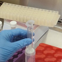 Video: Induction of Mesenchymal-Epithelial Transitions in Sarcoma Cells