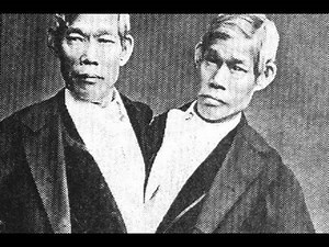 On the Separation of Conjoined Twins