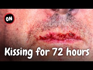 What Happens When You Kiss for 72 Hours?