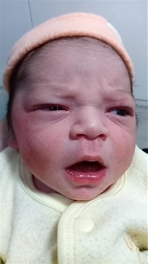 Healthy Newborn Baby in NICU | Observation Care & Good Reflex Moment