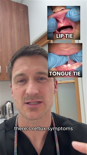 Tongue & Lip Ties can be remove using Laser