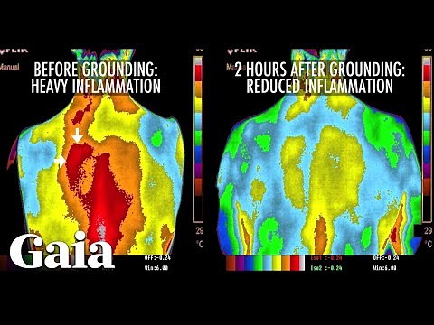 This is How EARTHING Reduces INFLAMMATION in the Body