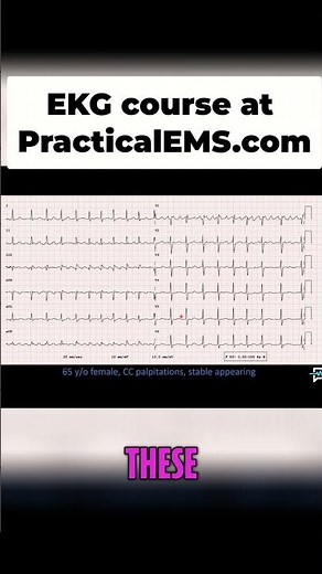 ECG Quick Guide: Spot Atrial Flutter Waves Like a Pro! #shorts