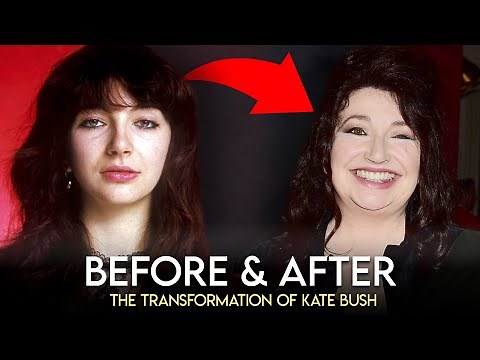 Kate Bush | Before & After | Plastic Surgery Transformation