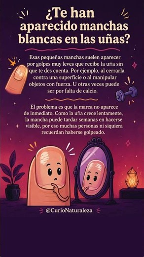 ¿Por qué aparecen manchas blancas en las uñas?La explicación te sorprenderá #SabiasQue #Curiosidades