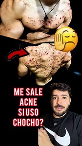 15K views · 35K reactions | El uso de esteroides no solo deja marcas visibles, como el acné, sino que también puede traer consecuencias que no se ven a simple vista: alteraciones hormonales, daño en el hígado, problemas cardíacos y afectaciones emocionales. Antes de decidirte por un atajo, infórmate bien, consulta a un profesional y piensa en el impacto real para tu salud a largo plazo #fit #gym #acne #ejercicio #fitness | Fisioentrena | Facebook