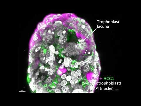 Scientists grow whole model of human embryo from stem cells in lab