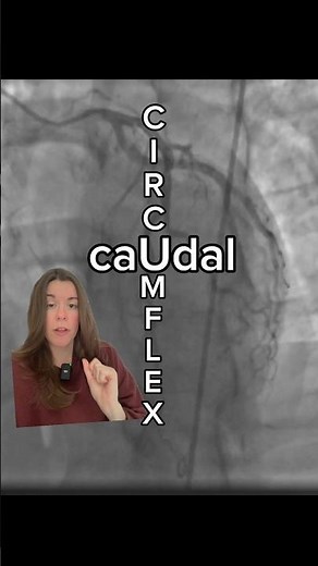 LAO CRANIAL - Made Easy! #cathlab #cardiology #angiography