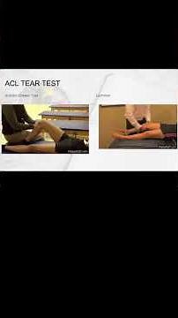 ACL Tear Test: Expert Explains Anterior Drawer & Lachman!