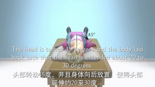 Dix-Hallpike试验