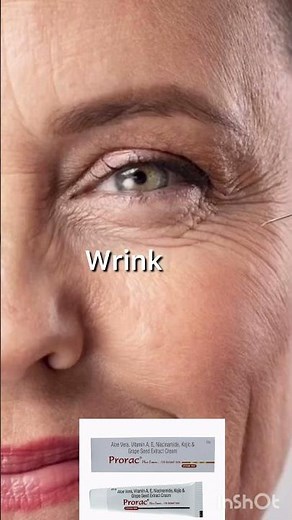 prorac plus cream for radiant skin review