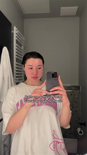 IG Hana.bche 🩷 #acne #skincare #glowskincare #skincaretips