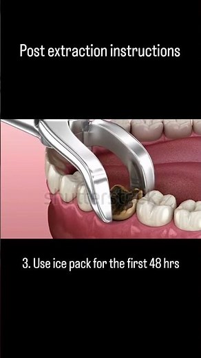 Post Extraction Instructions #dentistry #shorts