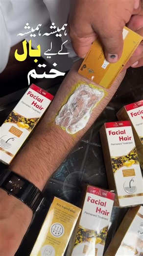 Permanent Hair Removal Treatment for Smooth Skin