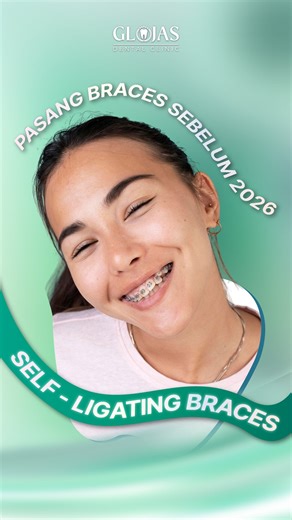 GLOJAS DENTAL CLINIC KUALA LUMPUR, MALAYSIA on Instagram: "Sedia untuk buang gigi bengkok dan langkah ke tahun 2026 dengan senyuman yang serba baharu? ✨ Di Klinik Pergigian GLOJAS, kami ada Self-Ligating Braces. 🦷 #dentalclinickualalumpur #SelfLigatingBraces #SmileTransformation #BracesJourney #KualaLumpurDentist #NewYearNewSmile #DentalCare #Orthodontics #2026Goals #DentalHealth #OralHygiene #DentistTips #OralHealthHacks #DentalCareMadeEasy #HealthyHabits #FreshSmile #OralHealthGoals #PlaqueBe
