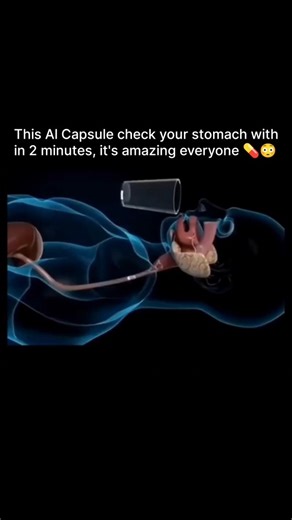 Technology on Instagram: "Al Capsule check your stomach within 2 minutes A new Al-powered capsule endoscopy system can perform a stomach exam in as little as eight minutes. This technology has been highlighted in recent reports from China. Key Details Procedure Time: The process of swallowing the capsule and completing the stomach exam is reported to take approximately 8 minutes. The capsule then passes naturally through the digestive system over the next 24 hours or more. Technology: This is a 