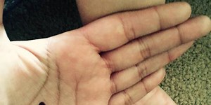 Why The Black Dot Campaign is helping women worldwide