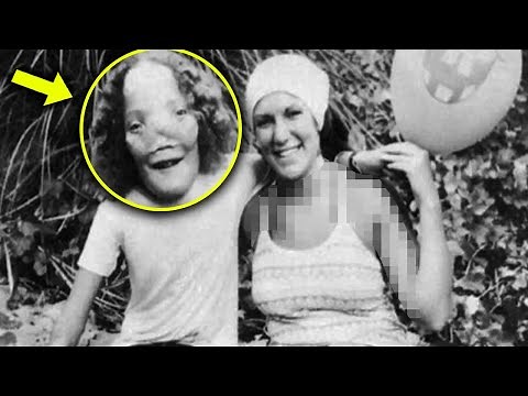 Rocky Dennis The true story of the boy who inspired ‘Mask’