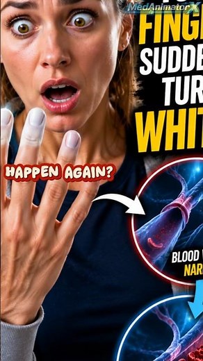 🤚 Why Do Your Fingers Suddenly Turn White? #medanimatorx #overcomeoverthinking #medicalfacts #facts