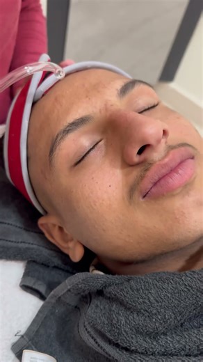 High frequency machine ✌🏻it is use for acne treatment, wrinkles