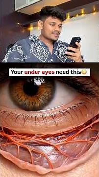 Under eyes 🫣😱