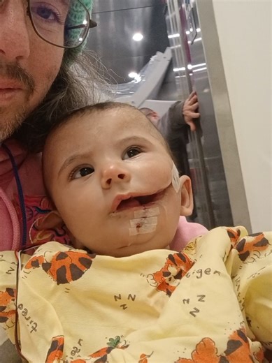 guys he did so so so good. his surgeon said it couldn't have gone better. thank you everyone for all of the prayers and positive vibes. they didn't go to waste ❤️ #surgery #baby #recovery #success #fyp