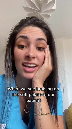 Soft Palate Bruising: Causes and Symptoms Explained