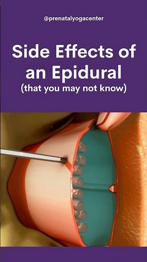 Side Effects of an Epidural